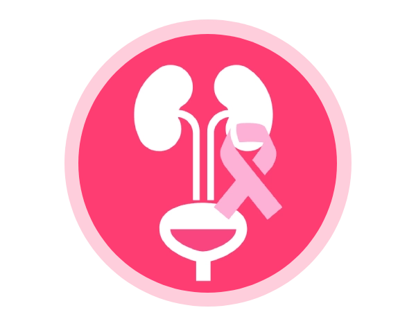 cancer-de-riñon-o-de-vejiga-urologia-mujeres-urologenirapuato.webp