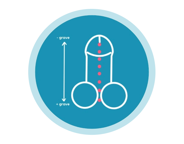 hipospadias-urologiapediatrica-urologoenirapuato.webp